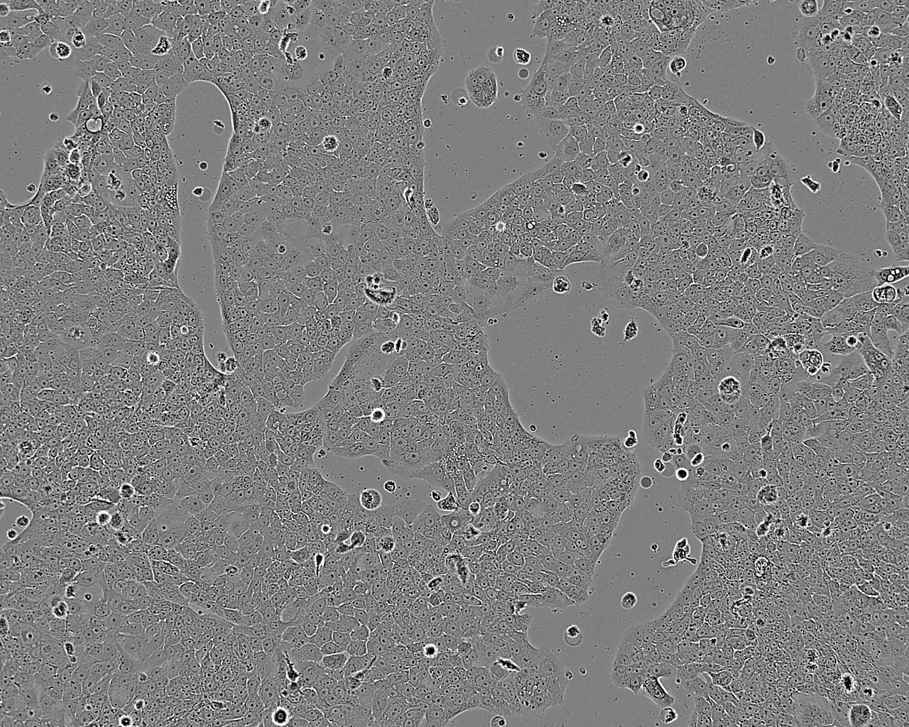 SW837 人直肠腺癌细胞