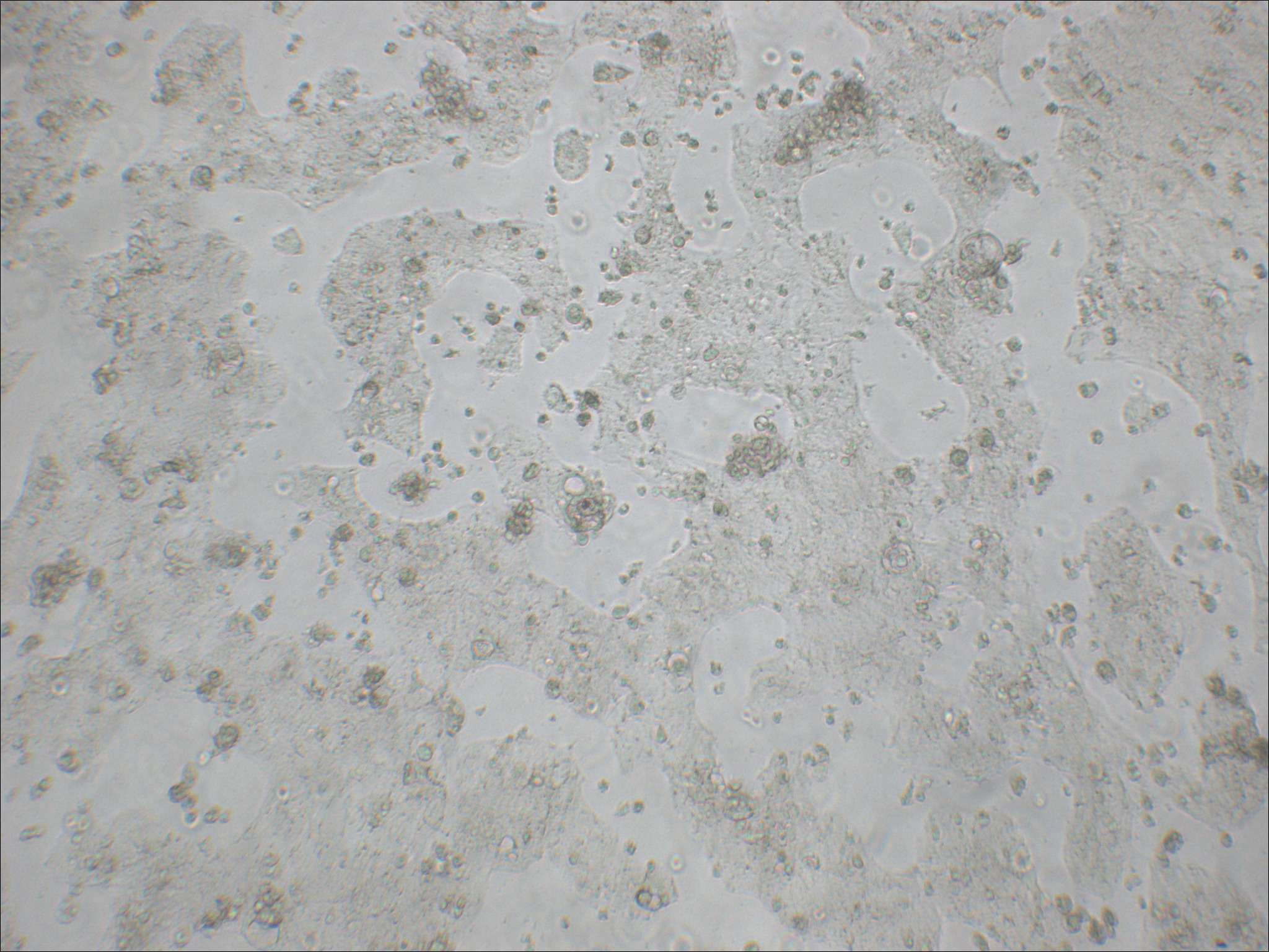 Caco-2 人结直肠腺癌细胞