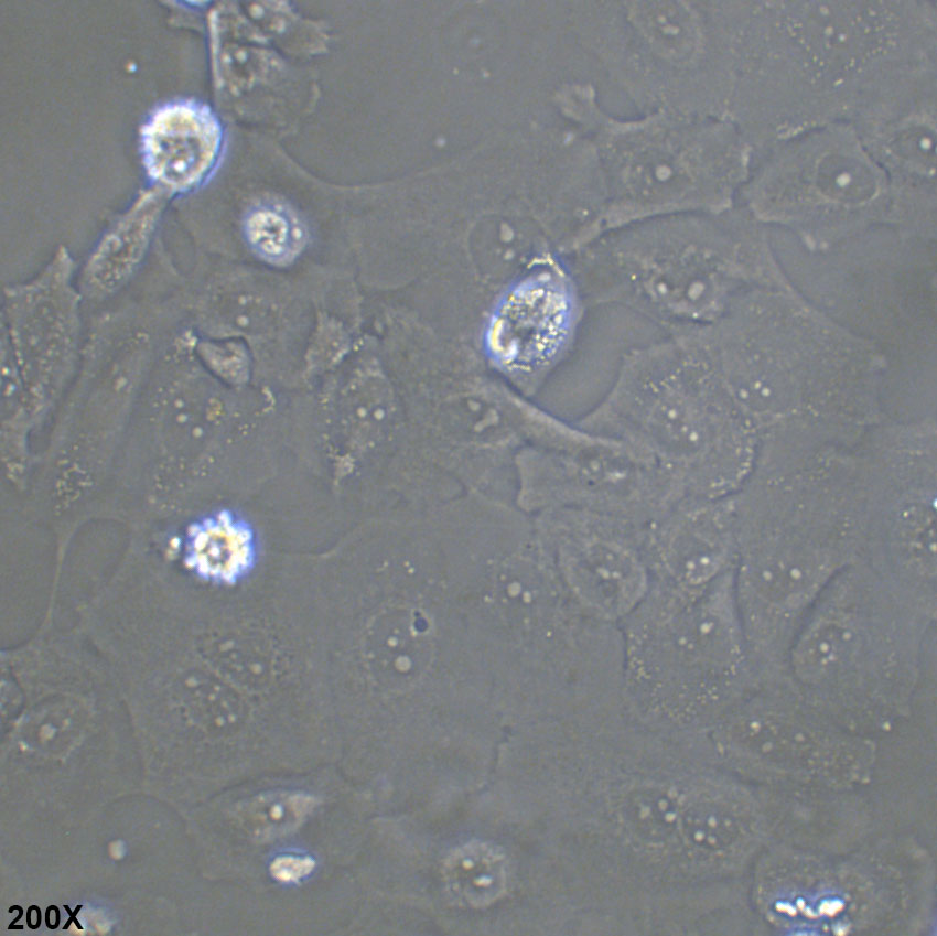 Caov-3 人卵巢癌细胞