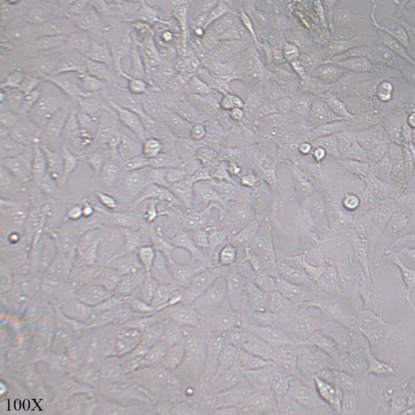 143B 人骨肉瘤细胞