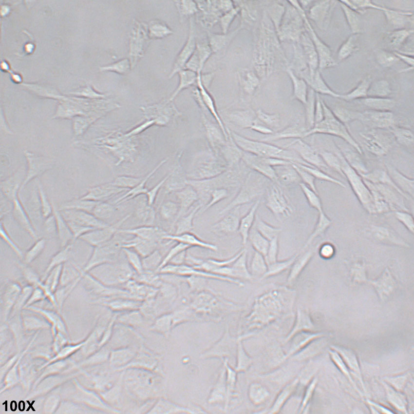 CCF-STTG1 人脑星形胶质细胞瘤细胞