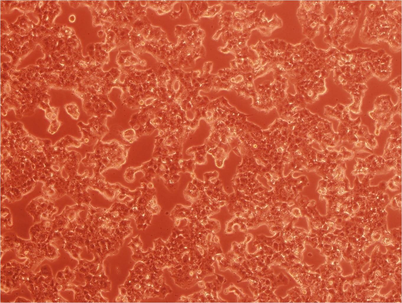 Beta-TC-6 小鼠胰岛素瘤胰岛β细胞