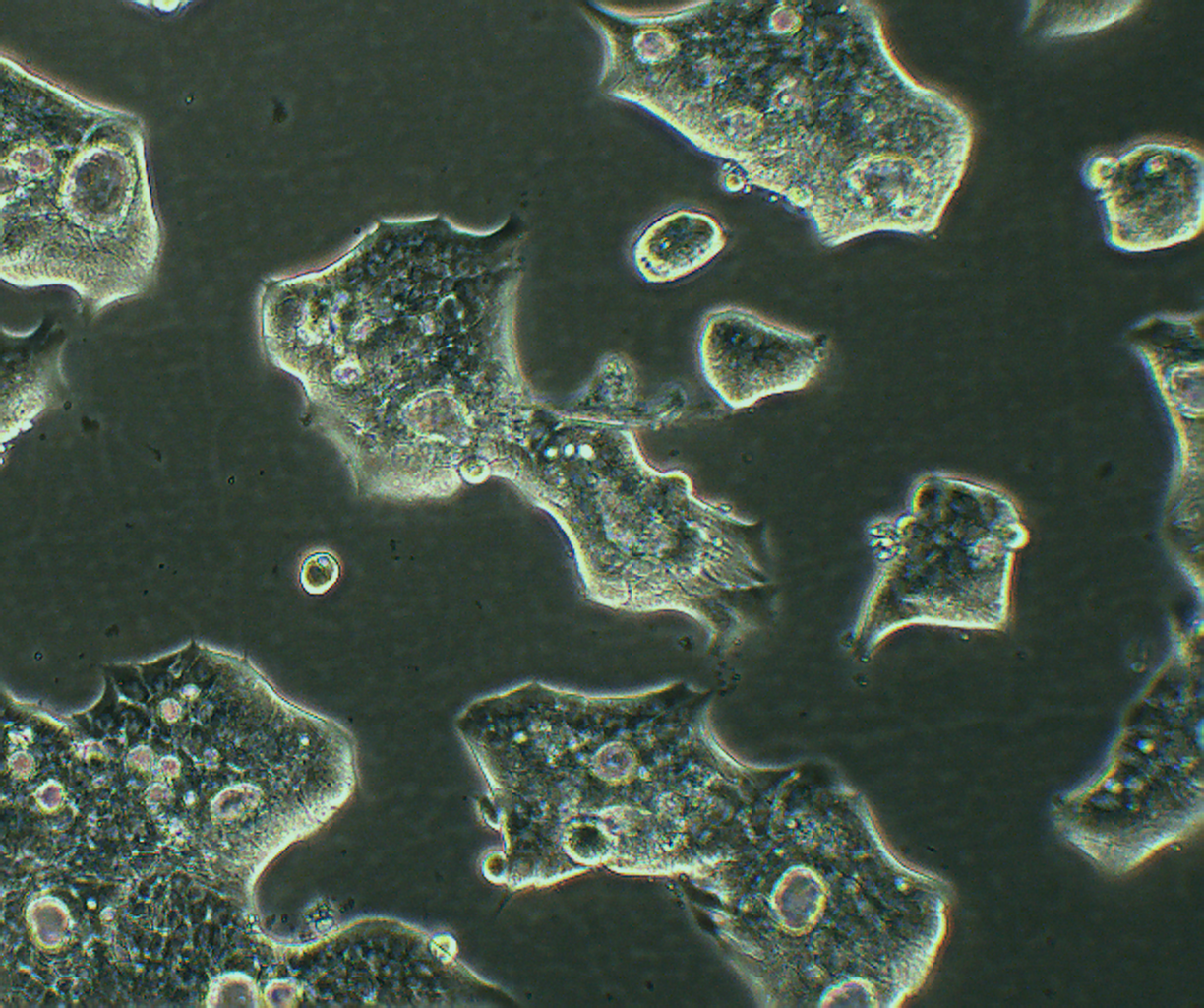 NCI-N87 人胃癌细胞