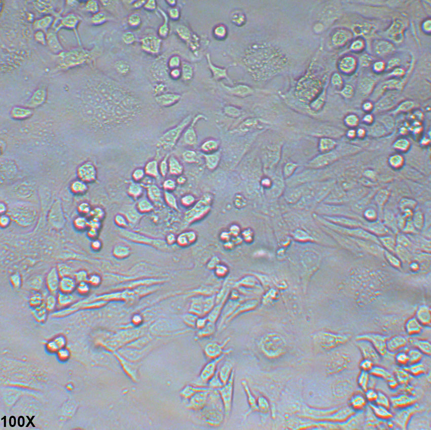 Anglne 人卵巢癌细胞