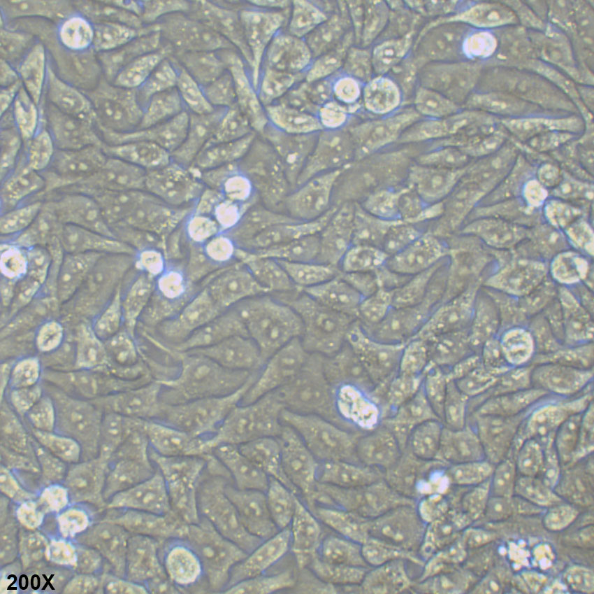 HGC-27 人胃癌细胞