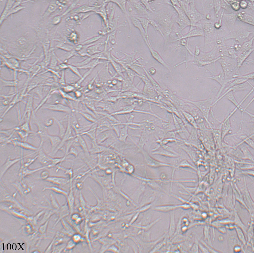 U-87 MG 人脑星形胶质母细胞瘤细胞