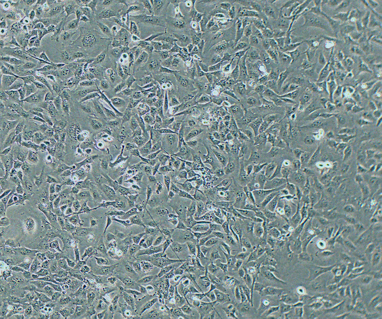 Nthy-ori 3-1 人甲状腺滤泡上皮细胞