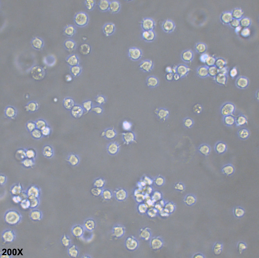 Jurkat E6-1 人急性T淋巴细胞白血病细胞