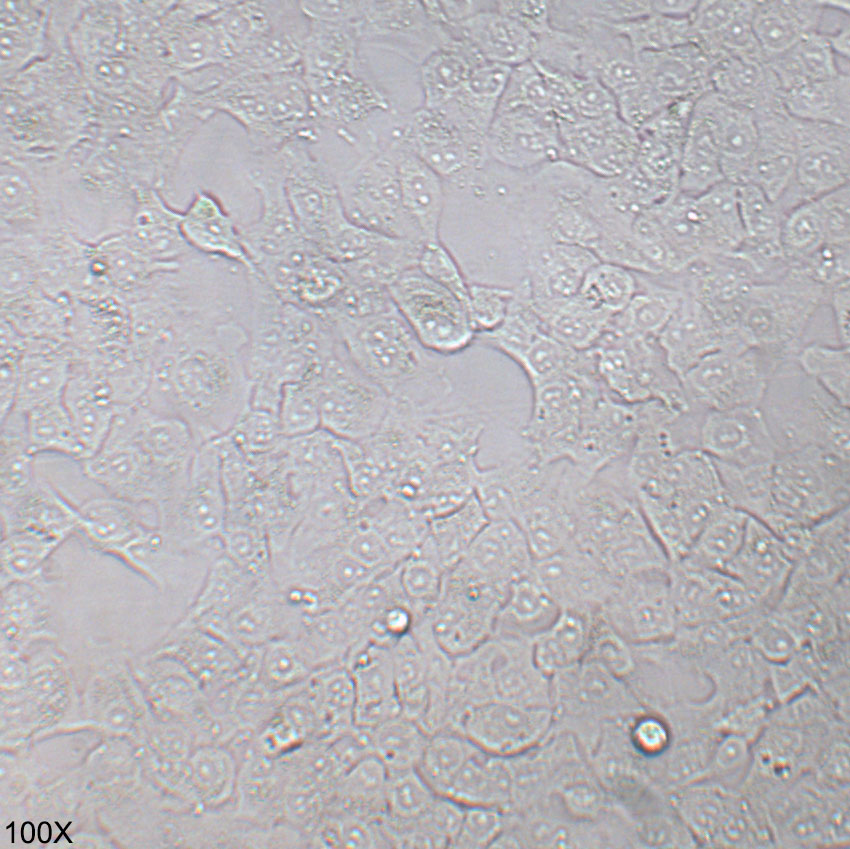 BHT-101 人甲状腺癌细胞（退行性）