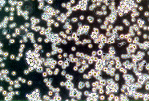Raji 黑人Burkitt淋巴瘤细胞