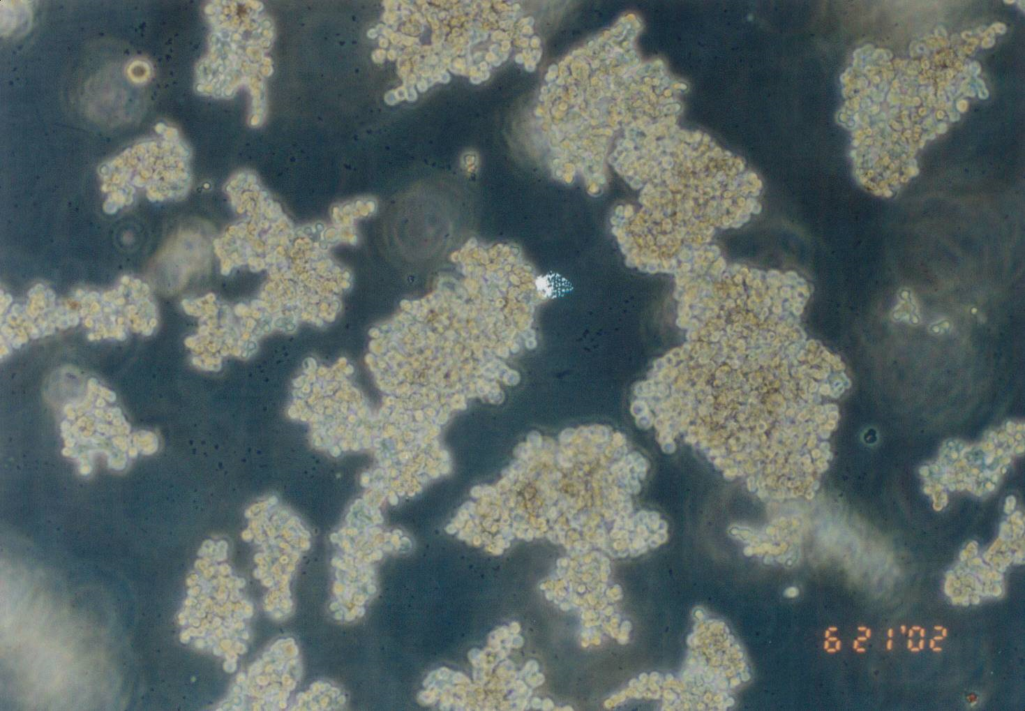 Y79 人视网膜母细胞瘤