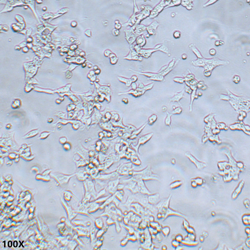 LoVo 人结肠癌细胞