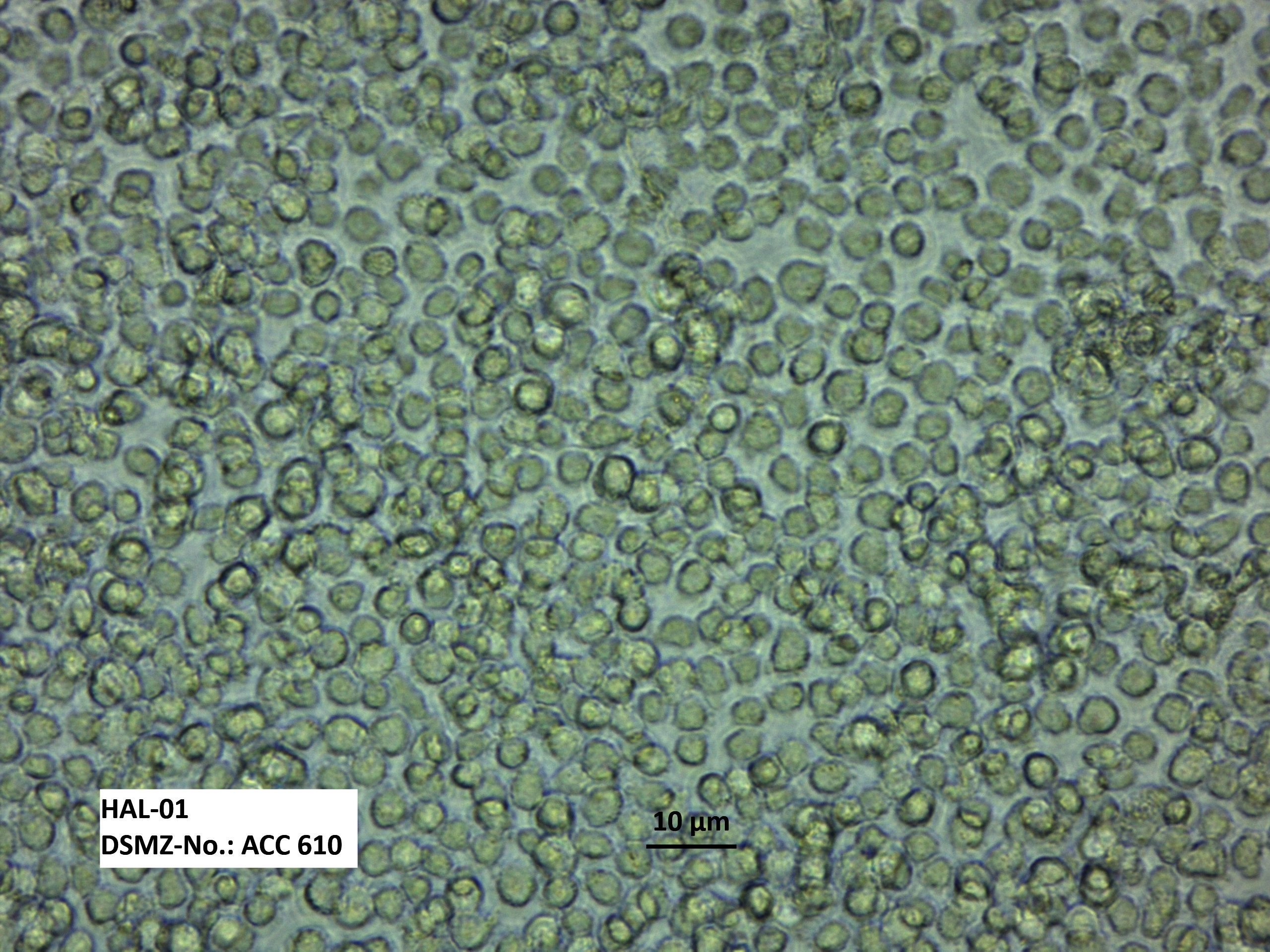 HAL-01 人急性淋巴细胞白血病细胞