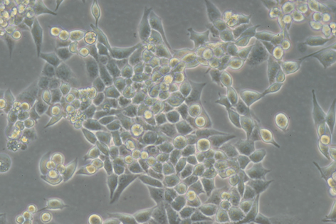 LLC 小鼠lewis肺癌细胞