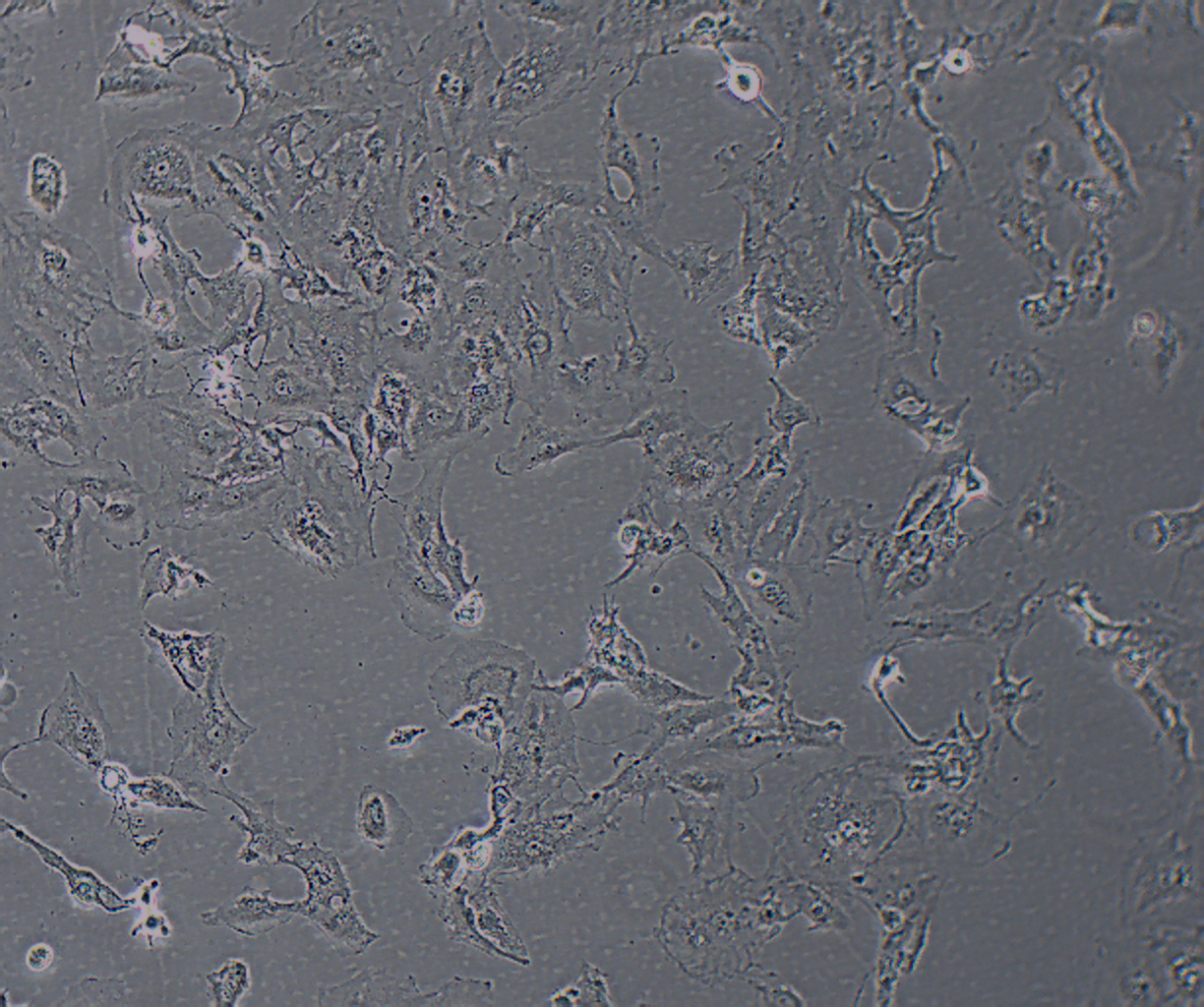 KGN 人卵巢颗粒细胞瘤细胞