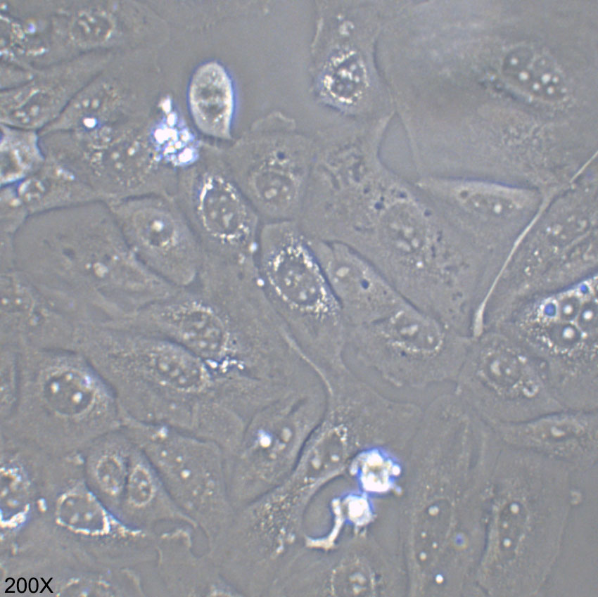 GBC-SD 人胆囊癌细胞