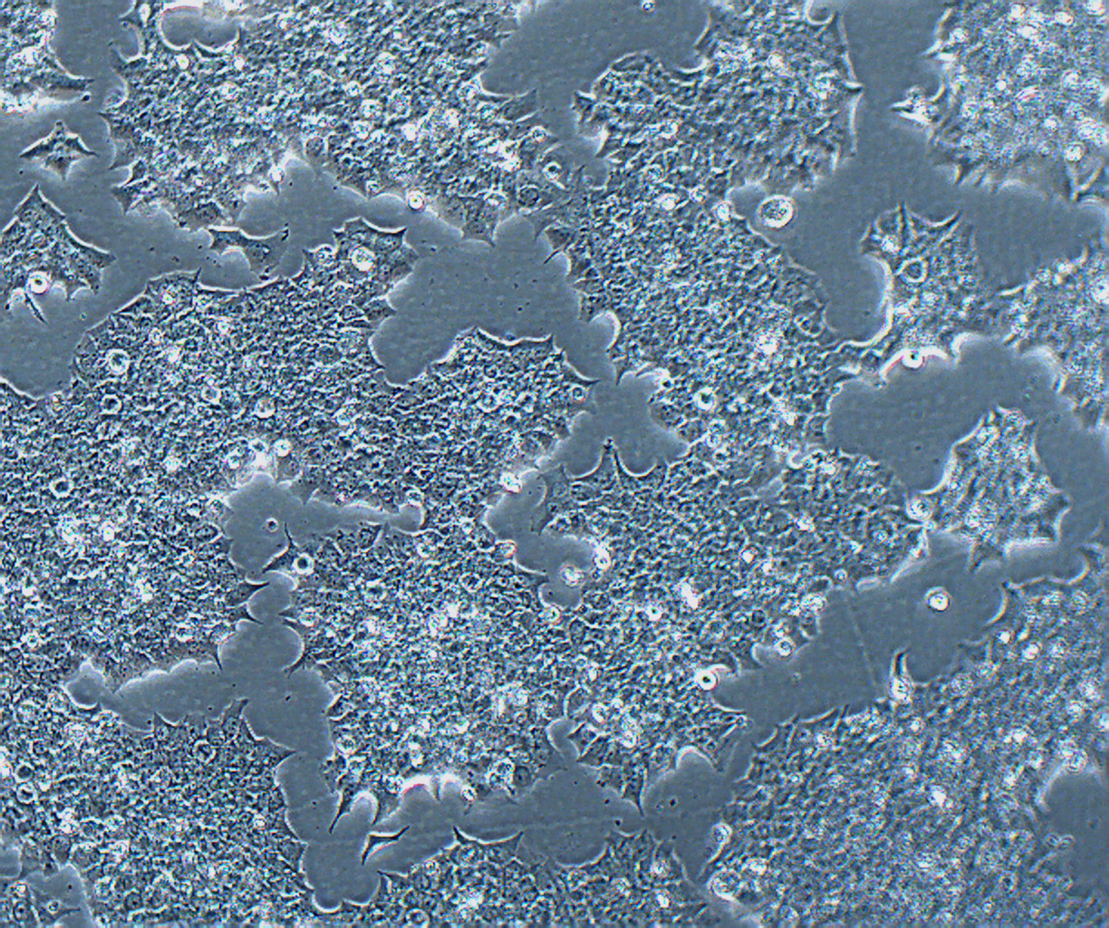 BT-474 人乳腺导管瘤细胞