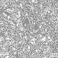 BT-20 人乳腺癌细胞