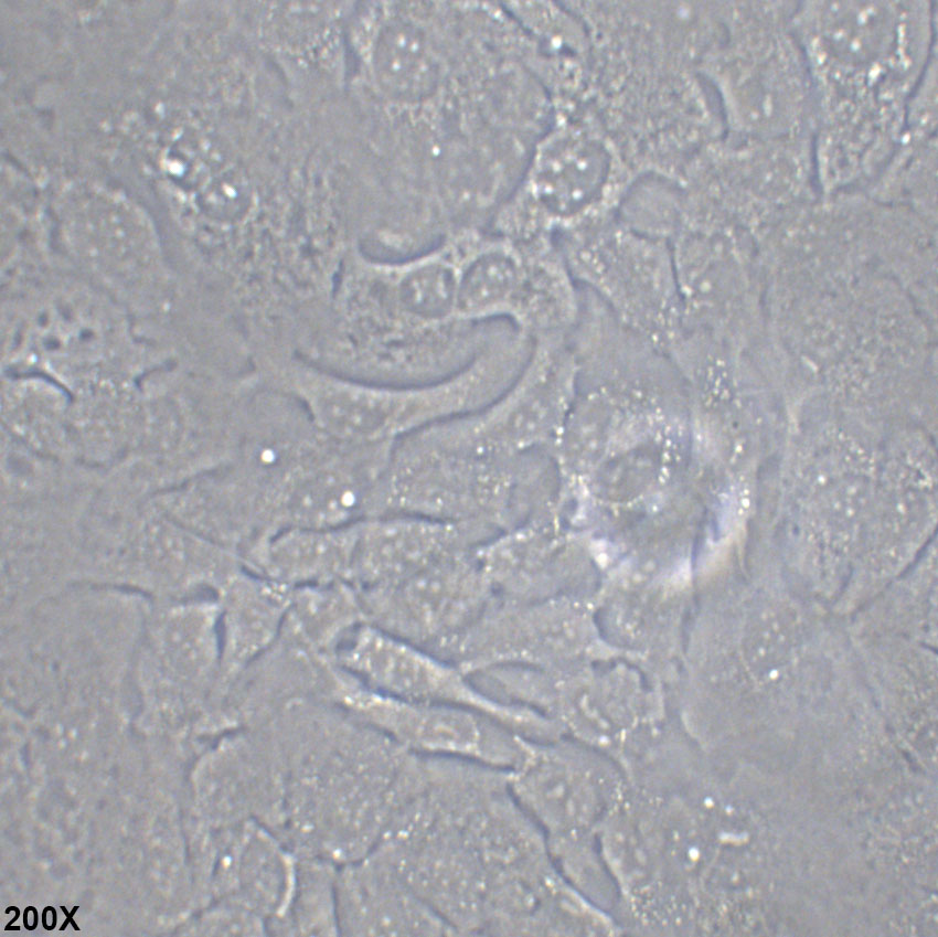 SK-OV-3 人卵巢腺癌细胞