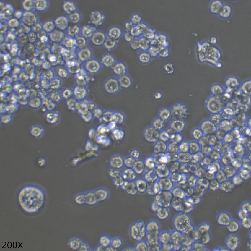 COLO 320DM 人结直肠腺癌细胞