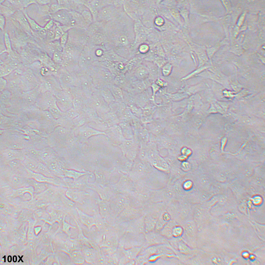 B-CPAP 人甲状腺癌细胞（乳头状）