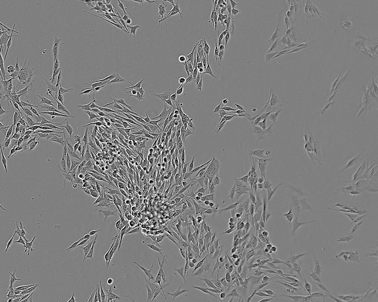 Mel202 人脉络膜黑色素瘤细胞