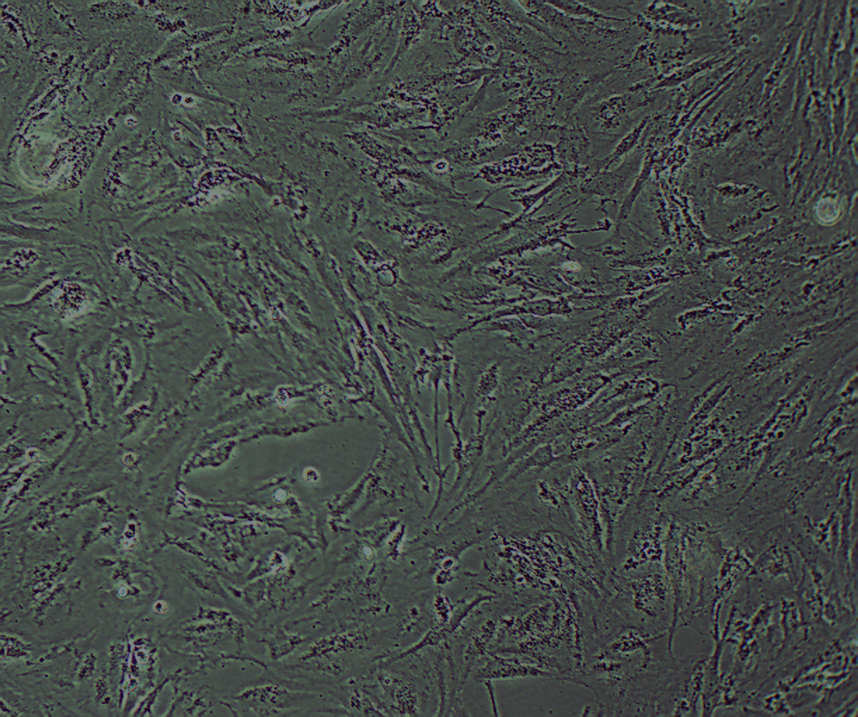 KGN 人卵巢颗粒细胞瘤细胞