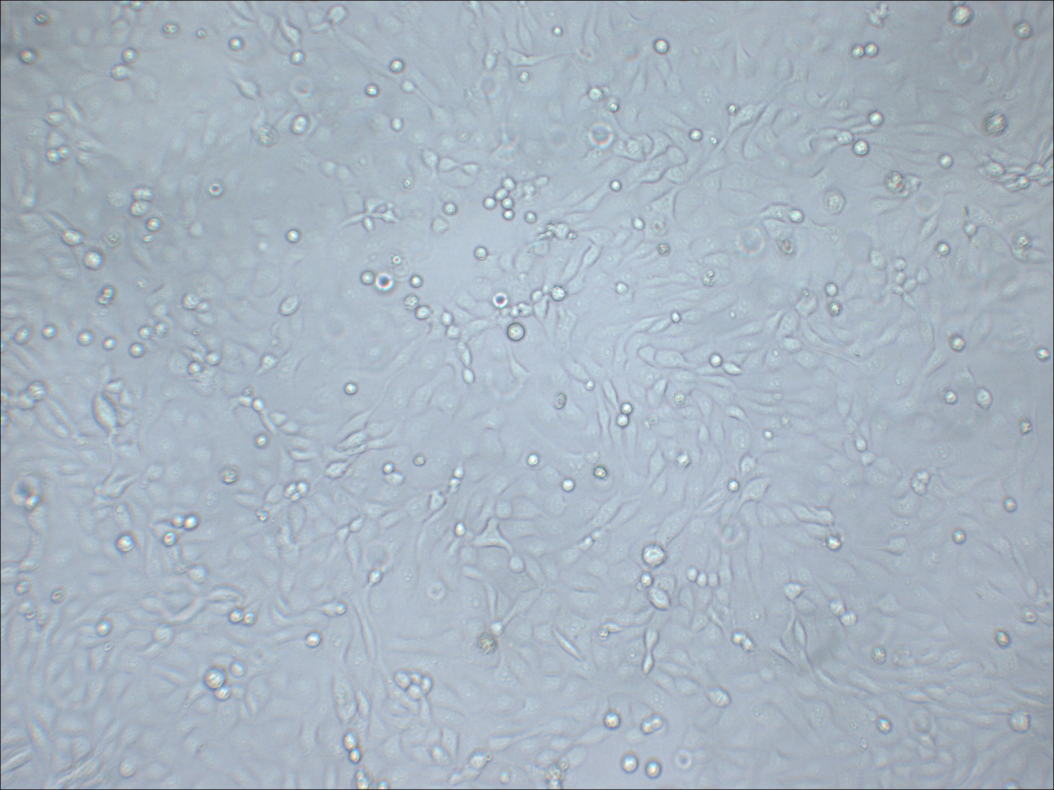 SNU-216 人胃癌细胞（淋巴转移）