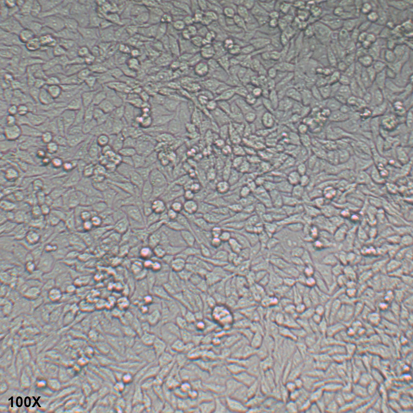 HGC-27 人胃癌细胞