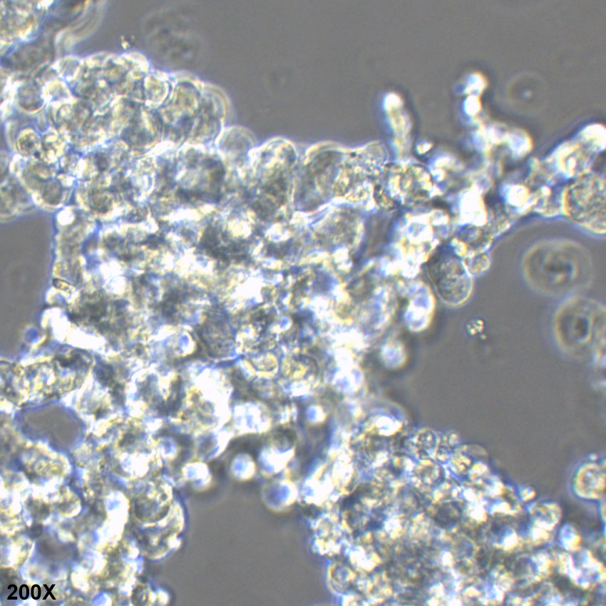NCI-H524 人小细胞肺癌细胞