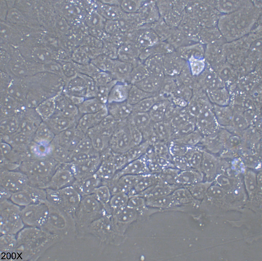 HCC827 人非小细胞肺癌细胞