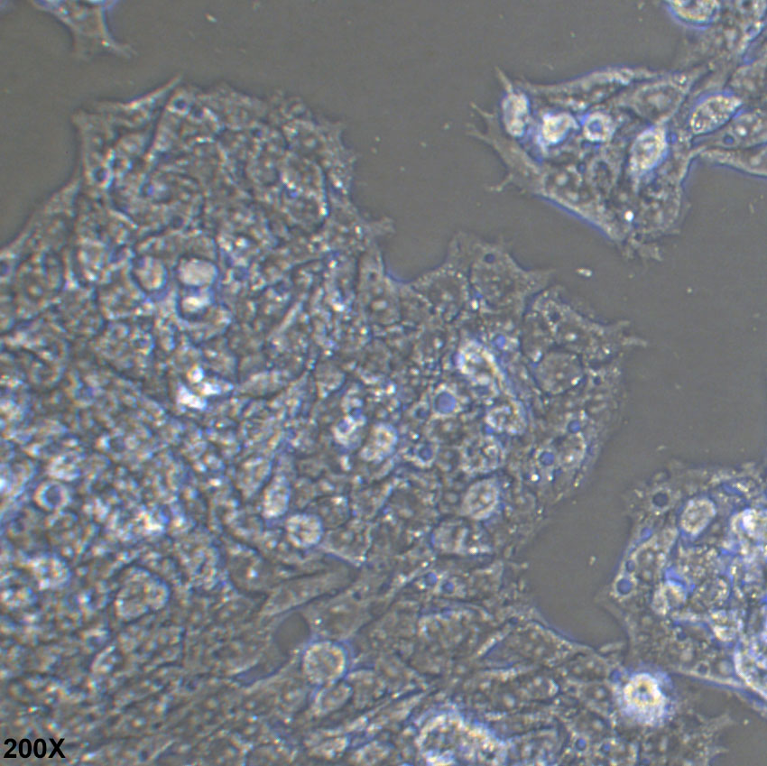 HepG2.2.15 表达HBV病毒的人肝癌细胞