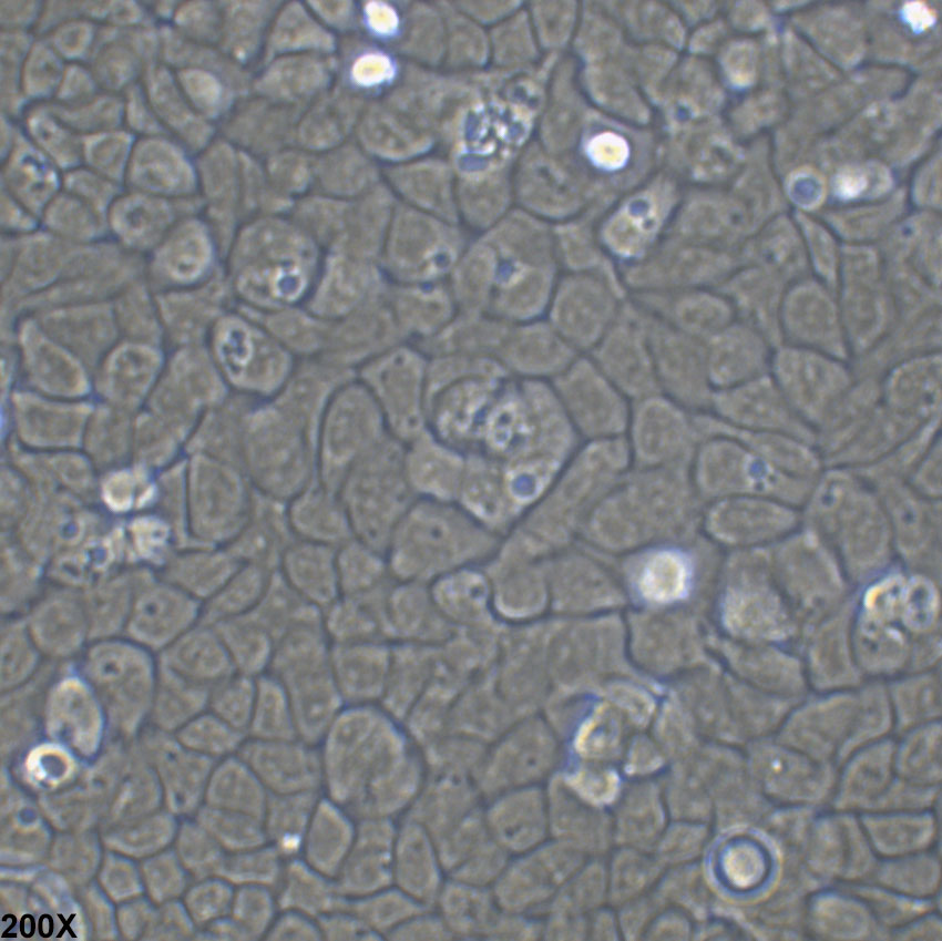 SW780 人膀胱移行细胞癌细胞
