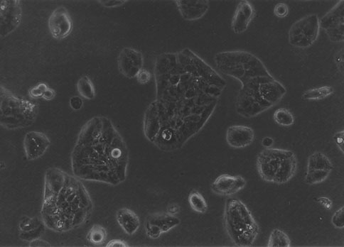 Li-7 人肝癌细胞