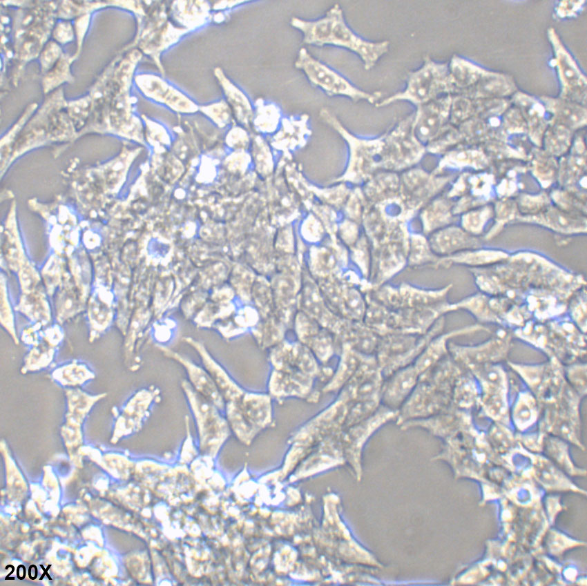 22Rv1 人前列腺癌细胞