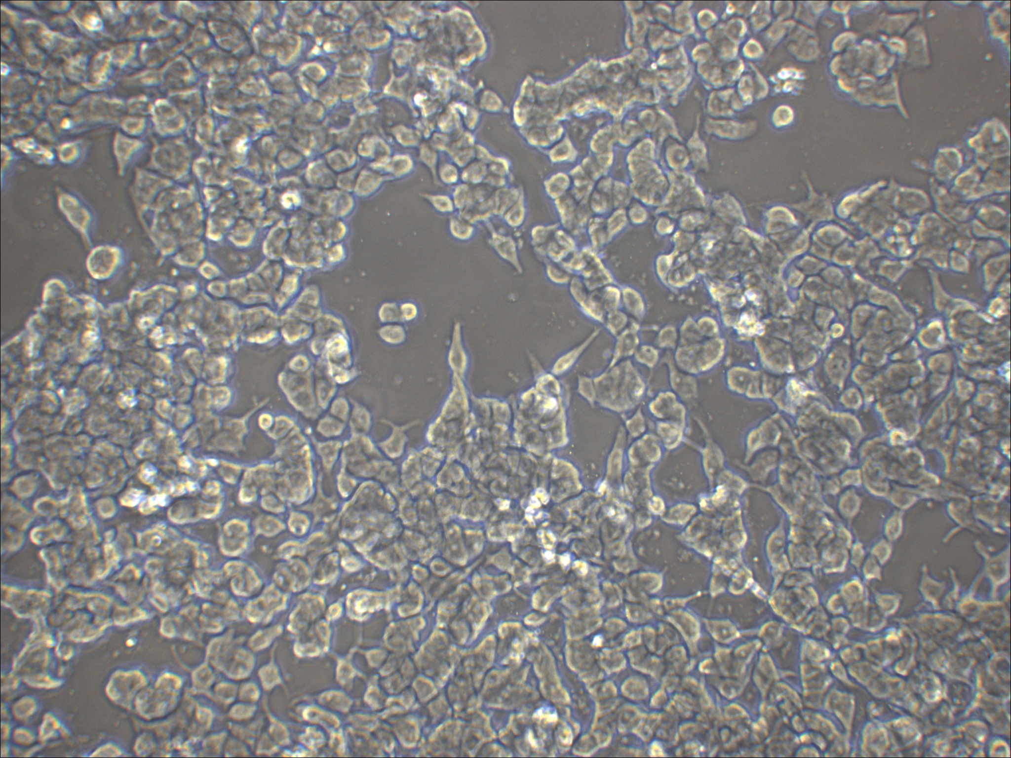 NCI-H3122 人肺腺癌细胞