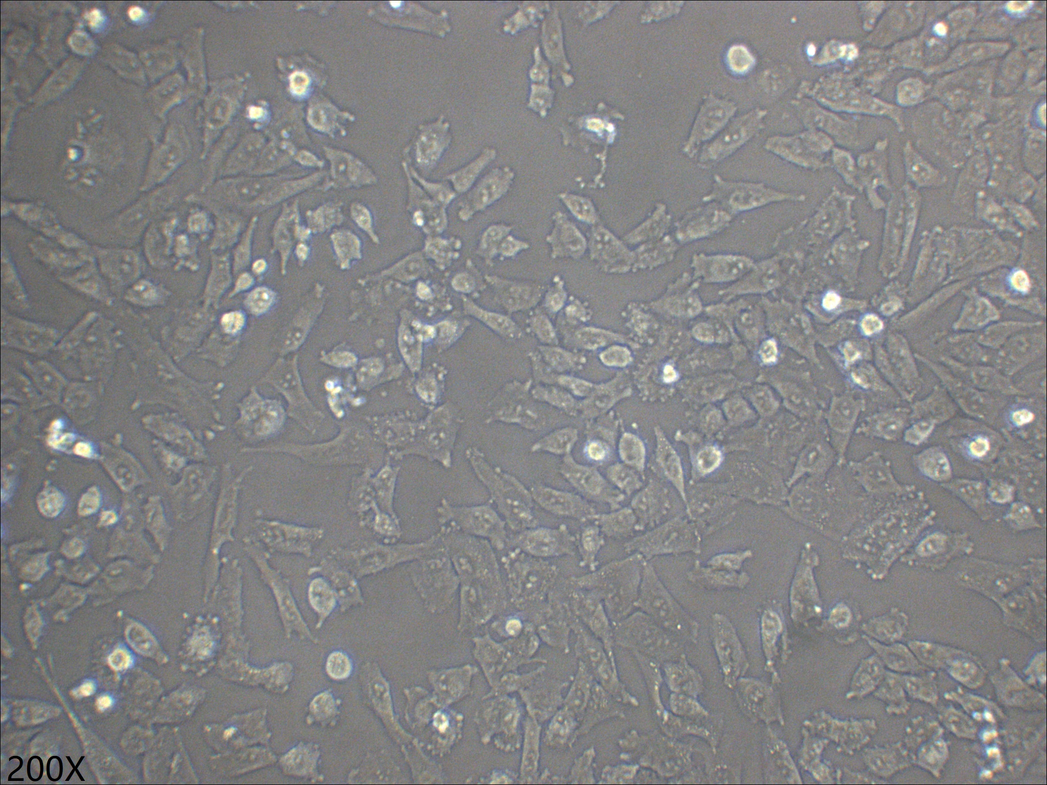 NCI-H1703 人肺鳞癌细胞