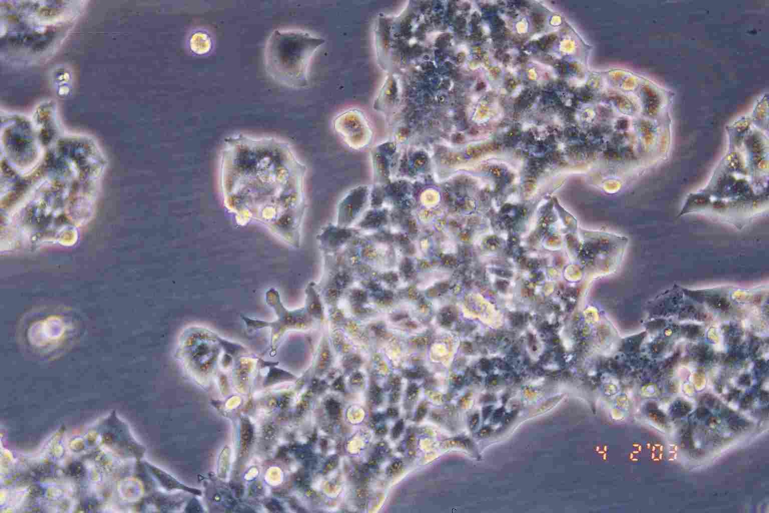 NCI-H520 人肺鳞癌细胞