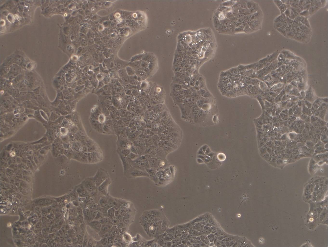 MS751 人子宫颈表皮癌细胞