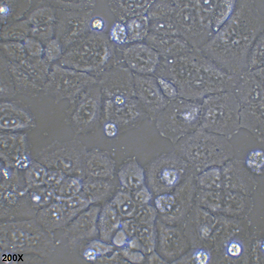 NCI-H460 人大细胞肺癌细胞