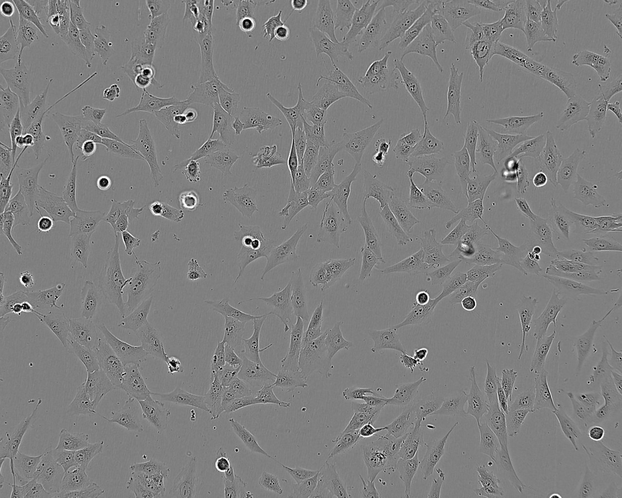 MG-63 人成骨肉瘤细胞
