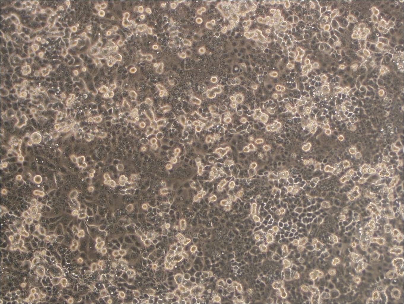 HEC-1-A 人子宫内膜腺癌细胞