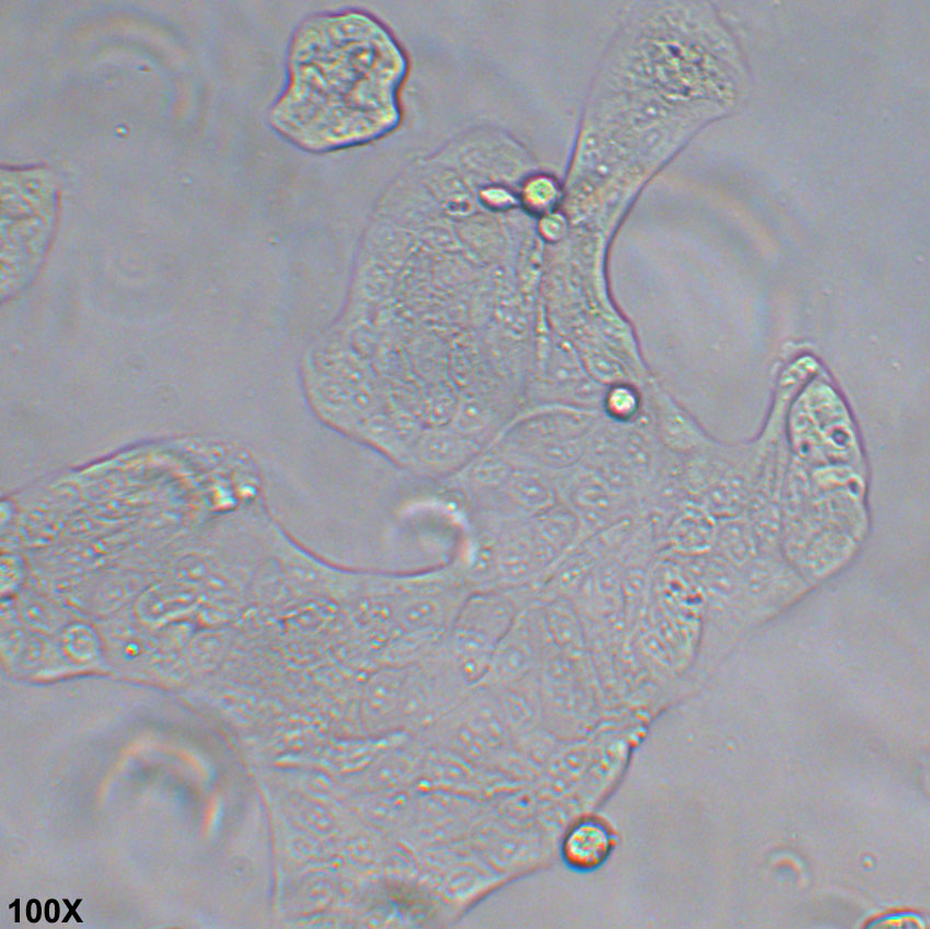 Calu-3 人肺腺癌细胞