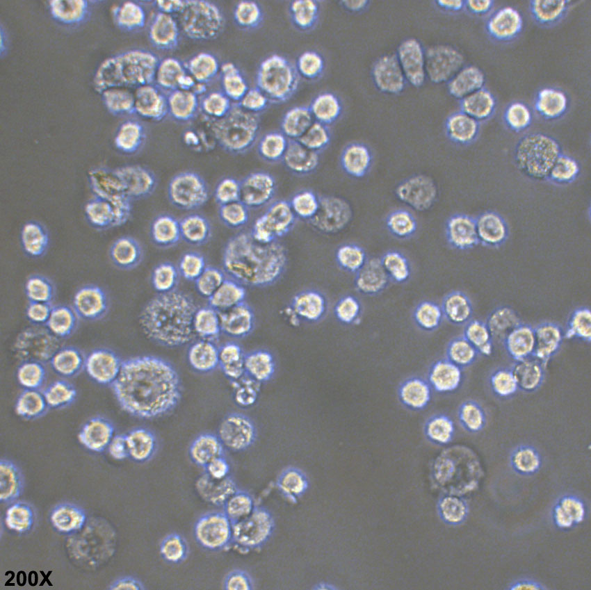 J774A.1 小鼠腹水单核细胞瘤细胞