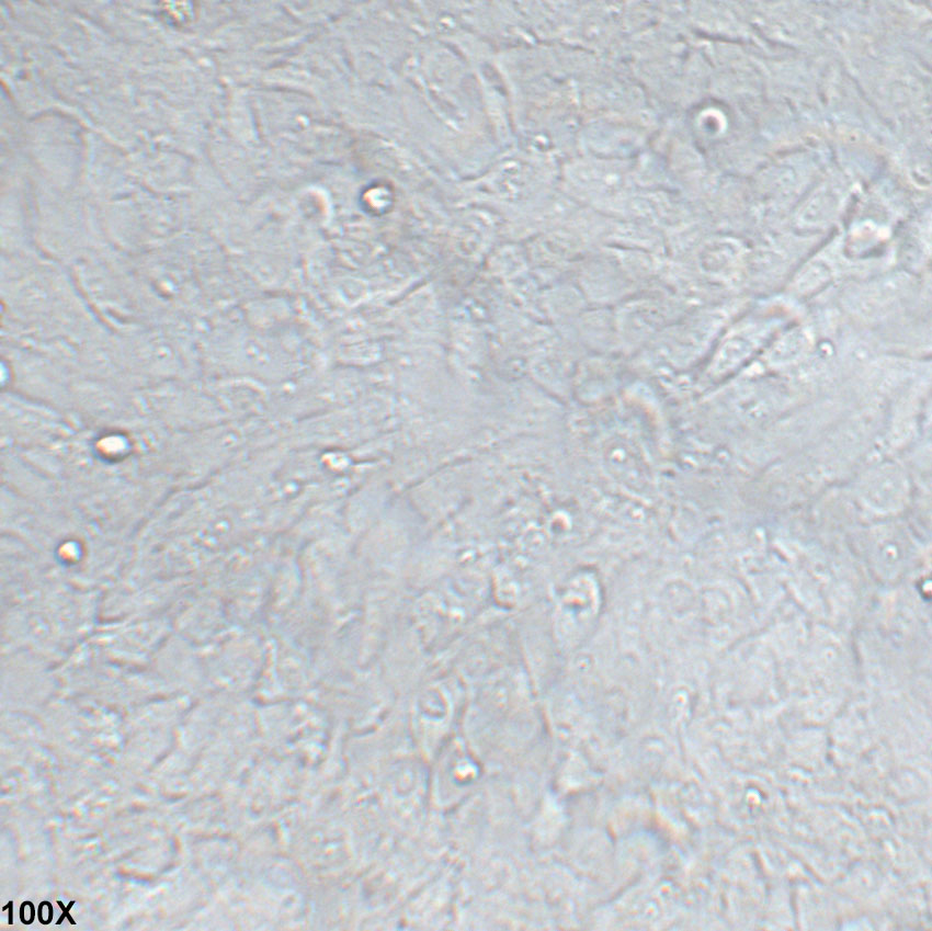 H4 人脑神经胶质瘤细胞