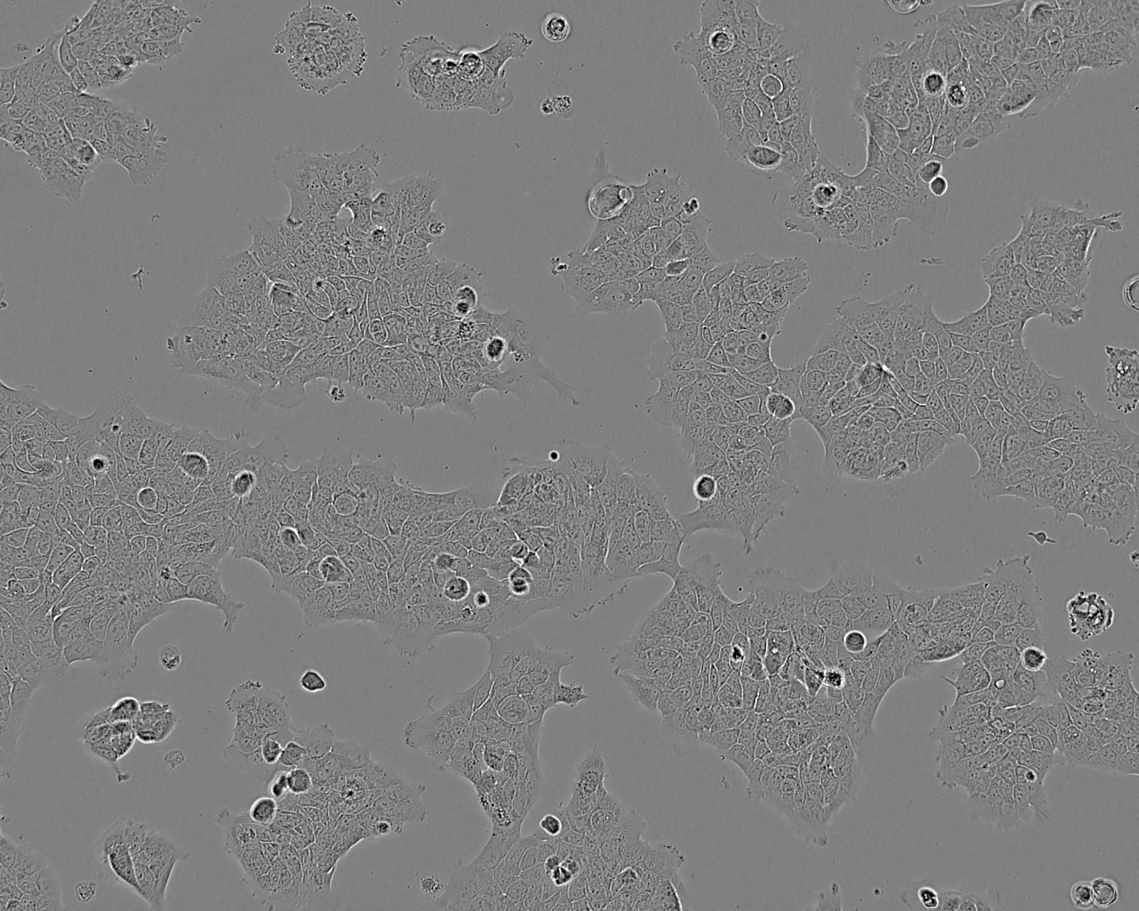RT4 人膀胱移行细胞乳头瘤细胞