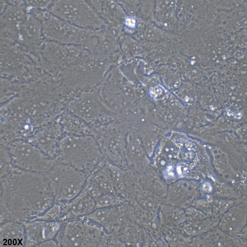PLC/PRF/5 人肝癌亚力山大细胞