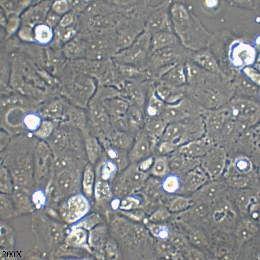 NIH/OVCAR-3 人卵巢腺癌细胞