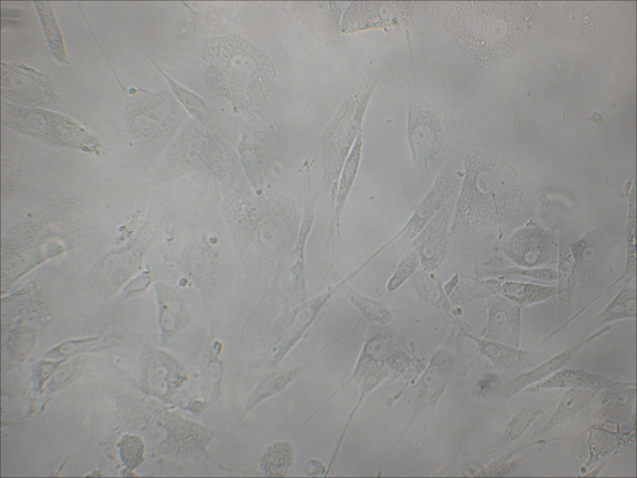 HTERT-HPNE 人永生化胰腺导管细胞