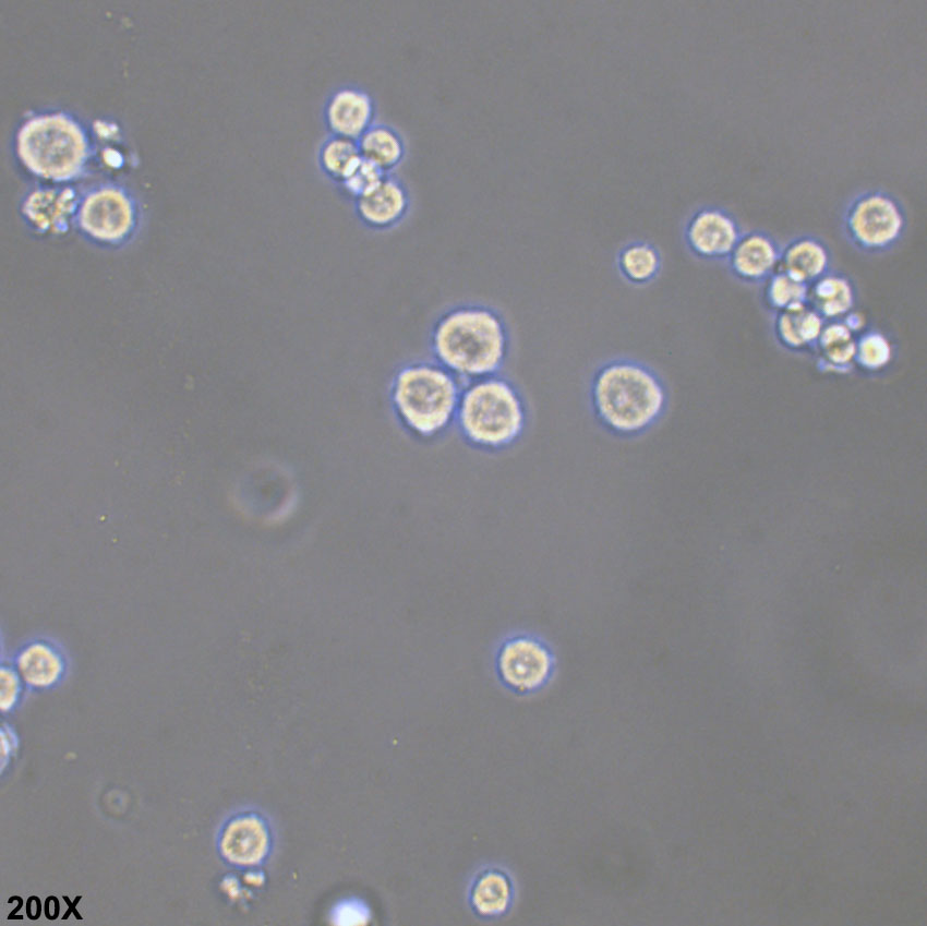 RPMI-8226 人多发性骨髓瘤外周血B淋巴细胞